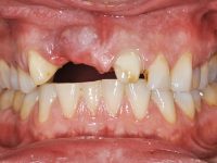 Before - Wiltondental